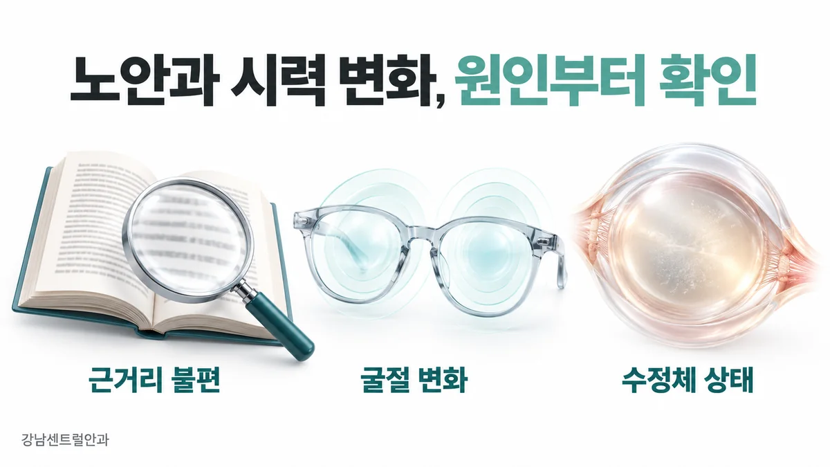 근거리 불편, 굴절 변화, 수정체 상태를 나누어 확인하는 시력 변화 개념도