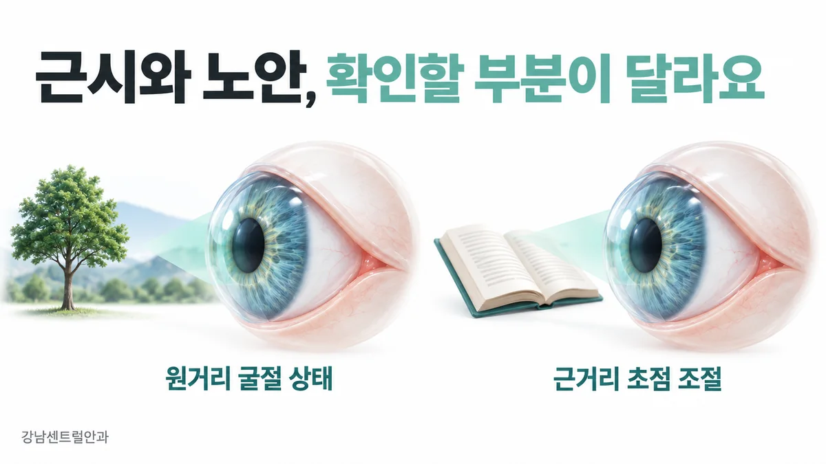 원거리 굴절 상태와 근거리 초점 조절을 별도로 확인하는 근시·노안 개념도