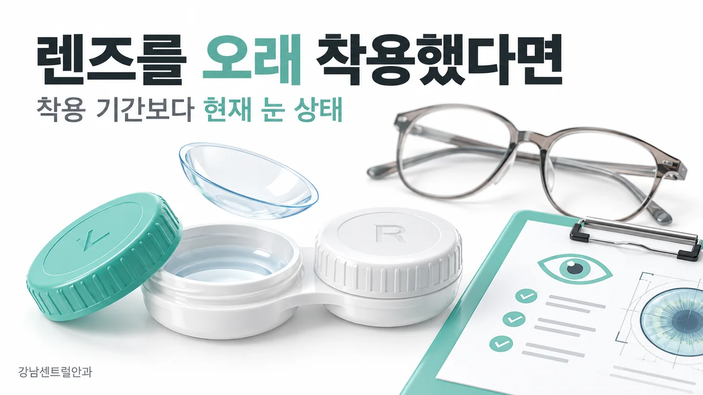 렌즈 오래 착용 라식의 핵심을 설명하는 의료 일러스트