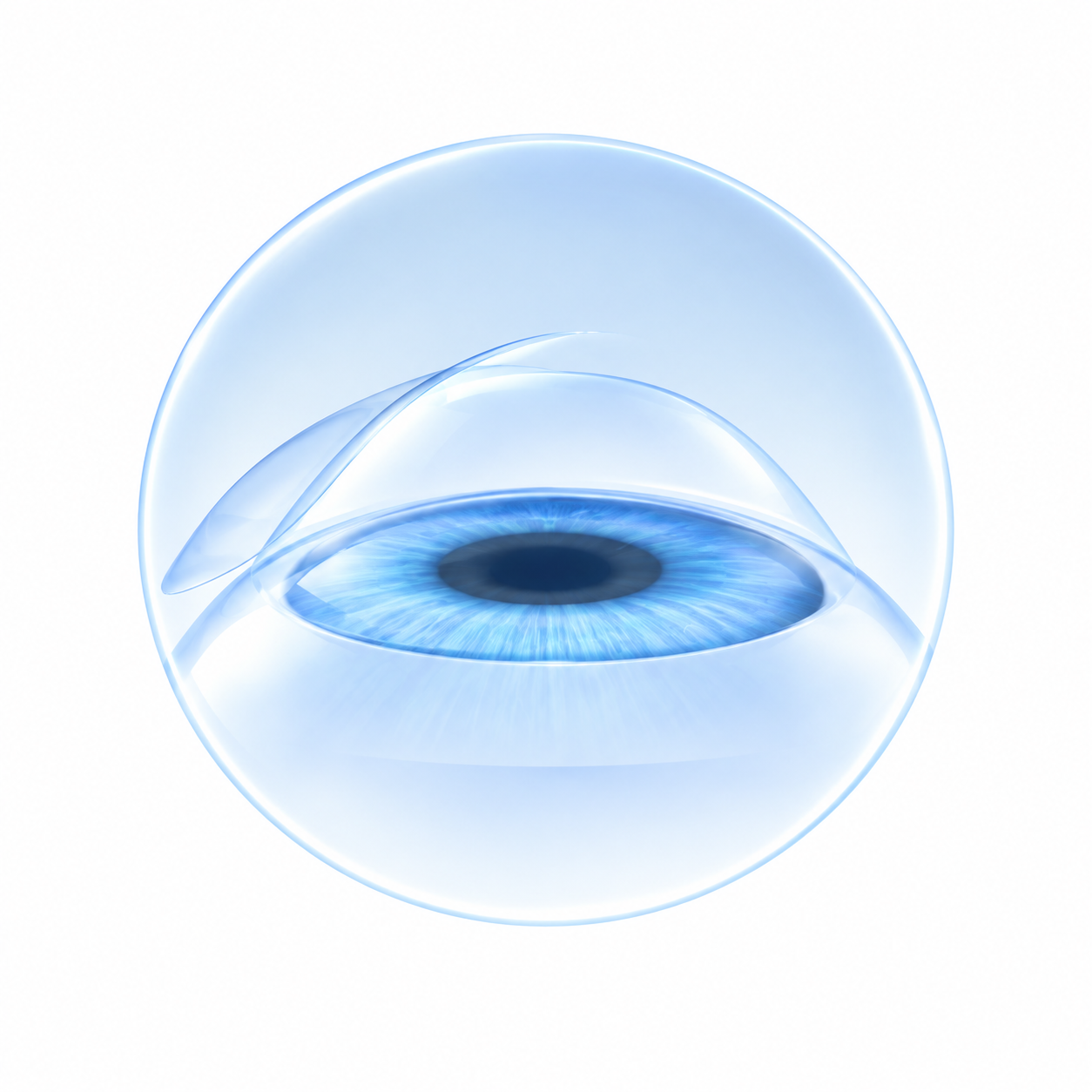 LASIK 방식을 설명하는 이미지