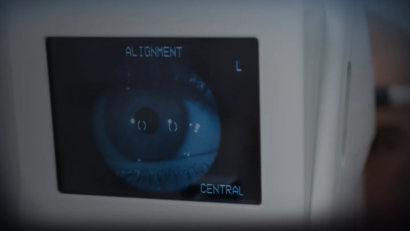 江南セントラル眼科の検査機器モニターに映る目の位置合わせ画面
