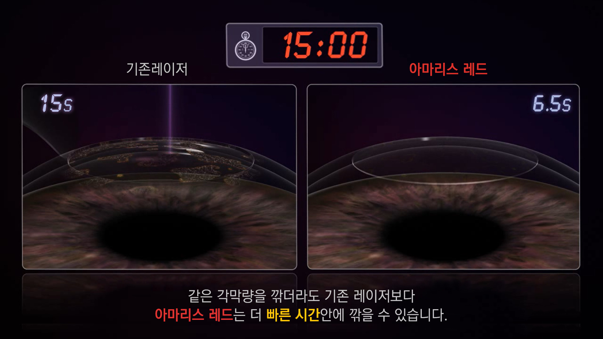 레이저 절삭 속도를 나타낸 장비 화면