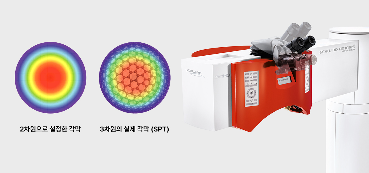 아마리스 레드 스마트펄스 기술을 나타낸 장비 화면