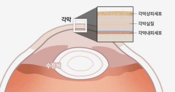 각막내피세포 수 기준을 나타낸 그래픽