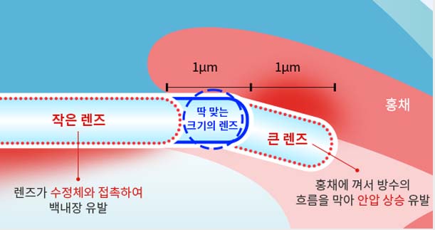 렌즈 크기에 따른 차이를 나타낸 그래픽